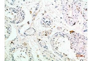 Immunohistochemical analysis of paraffin-embedded human-testis, antibody was diluted at 1:200 (PMCH antibody  (AA 112-161))