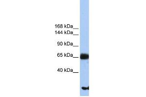 WB Suggested Anti-PIGO Antibody Titration:  0.