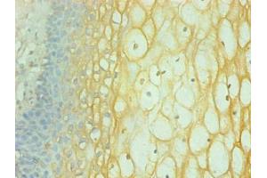 Immunohistochemical of paraffin-embedded human cervical using ABIN7156588 at dilution of 1:200 (Interferon gamma antibody)