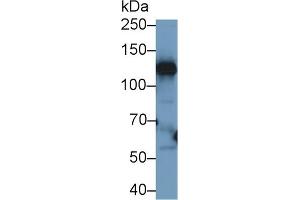 Western Blotting (WB) image for anti-Ceruloplasmin (Ferroxidase) (CP) (AA 789-1065) antibody (ABIN7429250)