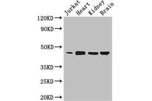 Western Blot Positive WB detected in: Jurkat whole cell lysate, Mouse heart tissue, Mouse kidney tissue, Mouse brain tissue All lanes: DOK2 antibody at 3.