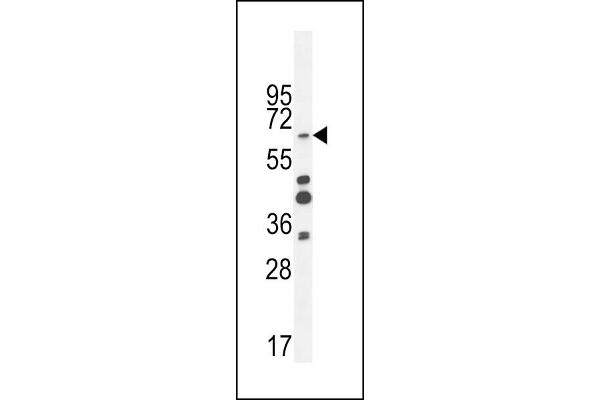 ZNF98 antibody  (C-Term)