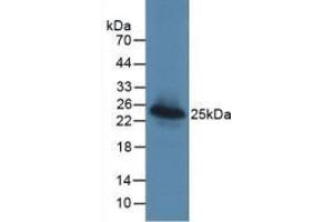 Detection of Recombinant LGALS3BP, Human using Monoclonal Antibody to Lectin Galactoside Binding, Soluble 3 Binding Protein (LGALS3BP) (LGALS3BP antibody  (AA 24-221))