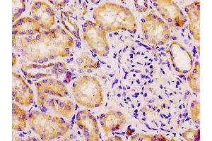IHC image of ABIN7149904 diluted at 1:100 and staining in paraffin-embedded human kidney tissue performed on a Leica BondTM system. (DLD antibody  (AA 398-495))