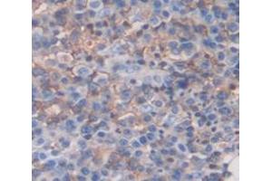 Figure. (DGAT1 antibody  (AA 180-427))