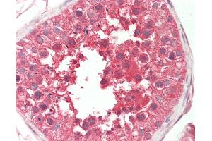 Anti-SPAG9 antibody IHC staining of human testis.