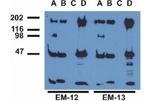 Immunoprecipitation ofEGFR from EGF-treated A431 cells by monoclonal antibodies EM-12 (A), (B), a commercial anti-EGFR polyclonal antibody (C)and anti-EGFR monoclonal mAb108 (D). (EGFR antibody  (Tyr1173))