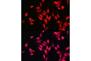 Immunofluorescence (IF) image for anti-Superoxide Dismutase 1, Soluble (SOD1) (AA 1-154) antibody (ABIN3020855)