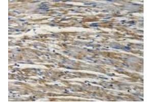 Figure. (PSMC4 antibody  (AA 1-418))