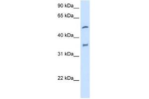 CYP2D6 antibody used at 2. (CYP2D6 antibody  (N-Term))