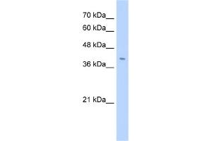 Western Blotting (WB) image for anti-Fibronectin Type III Domain Containing 3B (FNDC3B) (N-Term) antibody (ABIN2783881)