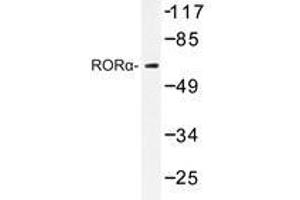 Western blot analysis of RORα antibody in extracts from HeLa cells. (RORA antibody)