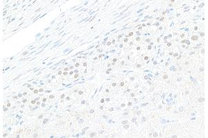 Immunohistochemistry (IHC) image for anti-GATA Binding Protein 4 (GATA4) (AA 392-442) antibody (ABIN7453878) (GATA4 antibody  (AA 392-442))