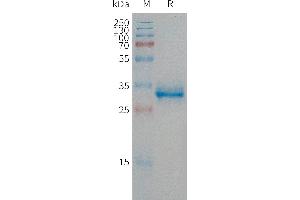 SDS-PAGE (SDS) image for Calcitonin-Related Polypeptide alpha (CALCA) (AA 83-119) protein (Fc Tag) (ABIN7491487)