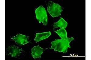 Immunofluorescence of purified MaxPab antibody to DAF on HeLa cell. (CD55 antibody  (AA 1-381))