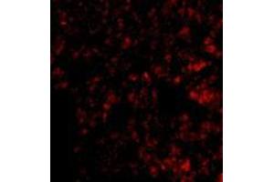 Immunofluorescence (IF) image for anti-PR Domain Containing 1, with ZNF Domain (PRDM1) (C-Term) antibody (ABIN499475)