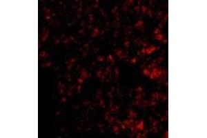 Immunofluorescence of Blimp-1 in mouse lung tissue with AP30154PU-N Blimp-1 antibody at 20 μg/ml. (PRDM1 antibody  (C-Term))