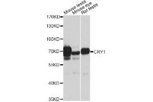 Western blot analysis of extracts of various cell lines, using CRY1 antibody (ABIN6291957) at 1:1000 dilution.