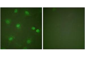 Immunofluorescence analysis of HeLa cells, using MEF2A (Ab-408) Antibody. (MEF2A antibody  (AA 374-423))