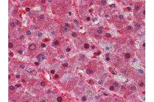 Immunohistochemical analysis of paraffin-embedded human liver tissues using LPA monoclonal antibody, clone 8F6A9 .