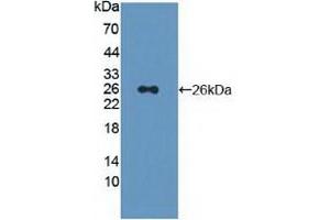 Detection of Recombinant PSMD5, Human using Polyclonal Antibody to Proteasome 26S Subunit, Non ATPase 5 (PSMD5) (Proteasome 26S Subunit, Non ATPase 5 (AA 143-341) antibody)