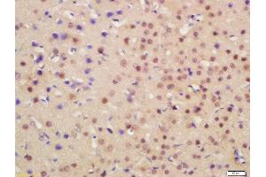 Formalin-fixed and paraffin embedded mouse brain labeled with Rabbit Anti-HRG beta 1 Polyclonal Antibody, Unconjugated  at 1:200 followed by conjugation to the secondary antibody and DAB staining (Hrg beta 1 (AA 65-150) antibody)
