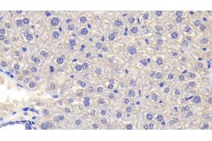 Immunohistochemistry (IHC) image for anti-Tumor Necrosis Factor alpha (TNF alpha) (AA 80-235) antibody (ABIN7429991)