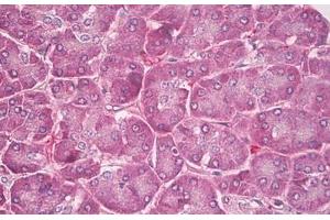 Image no. 2 for anti-Phospholipid Transfer Protein (PLTP) (C-Term) antibody (ABIN6749777) (PLTP antibody  (C-Term))