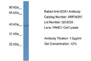 WB Suggested Anti-SOX1 Antibody   Titration: 1. (SOX1 antibody  (N-Term))