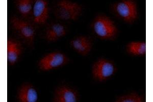 Immunofluorescence (IF) image for anti-Tetraspanin 26 (TSPAN26) (AA 112-241) antibody (APC) (ABIN5566694) (CD37 antibody  (AA 112-241) (APC))