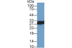 Western Blot; Sample: Human Lung lysate; Primary Ab: 1µg/ml Rabbit Anti-Human VAPA Antibody Second Ab: 0. (VAPA antibody  (AA 1-249))