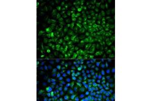 Immunofluorescence analysis of U2OS cells using COMT Polyclonal Antibody (COMT antibody)