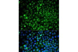 Immunofluorescence analysis of U2OS cells using COMT Polyclonal Antibody