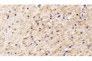 anti-Nerve Growth Factor (NGF) (AA 19-239) antibody