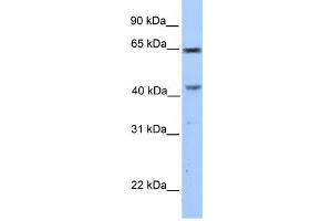 CCDC60 antibody used at 1 ug/ml to detect target protein. (CCDC60 antibody  (C-Term))