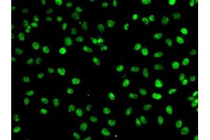 Immunofluorescence analysis of A-549 cells using PHF19 antibody (ABIN6128441, ABIN6145539, ABIN6145540 and ABIN6224090). (PHF19 antibody  (AA 1-207))