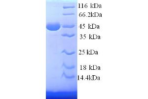 SDS-PAGE (SDS) image for Podocalyxin-Like (PODXL) (AA 32-458), (partial) protein (His tag) (ABIN4976482)