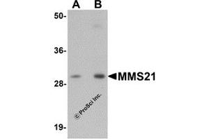 Western Blotting (WB) image for anti-E3 SUMO-Protein Ligase NSE2 (NSMCE2) (C-Term) antibody (ABIN1030522) (NSMCE2 antibody  (C-Term))