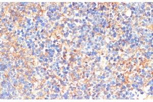 Immunohistochemistry of paraffin-embedded Mouse spleen using SIGLEC3/CD33 Polyclonal Antibody at dilution of 1:200 (40x lens). (CD33 antibody)