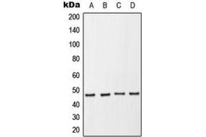 Western blot analysis of p47 phox (pS370) expression in HeLa serum starvation-treated (A), THP1 (B), Raw264. (NCF1 antibody  (C-Term, pSer370))