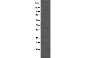 Western blot analysis of MKX expression in NCI-H460 cell line lysate ;,The lane on the left is treated with the antigen-specific peptide. (MKX antibody  (C-Term))