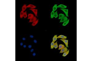 ABIN7095504 and ABIN7099561 staining Hela cells by IF/ICC. (VMP1 antibody)