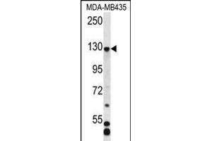 C7orf63 Antibody (N-term) (ABIN656362 and ABIN2845659) western blot analysis in MDA-M cell line lysates (35 μg/lane). (C7orf63 antibody  (N-Term))