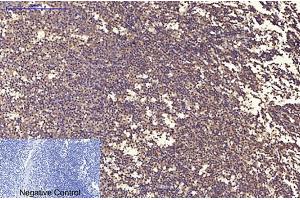 Immunohistochemical analysis of paraffin-embedded human tonsil tissue. (Ubiquitin antibody)