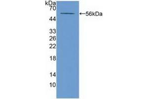 Detection of Recombinant ABCA13, Mouse using Polyclonal Antibody to ATP Binding Cassette Transporter A13 (ABCA13) (ABCA13 antibody  (AA 4692-4931))