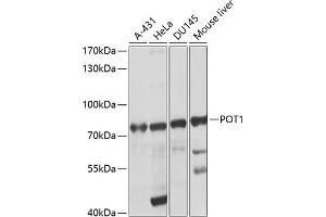 Western blot analysis of extracts of various cell lines, using POT1 antibody (ABIN3022020, ABIN3022021, ABIN5663924 and ABIN6218570) at 1:1000 dilution. (POT1 antibody  (AA 497-634))