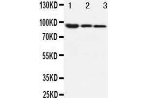 Anti-beta Catenin antibody, Western blotting Lane 1: MM453 Cell Lysate Lane 2: MCF-7 Cell Lysate Lane 3: HELA Cell Lysate (CTNNB1 antibody  (C-Term))