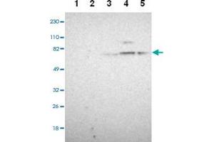 Western blot analysis of Lane 1: Human cell line RT-4, Lane 2: Human cell line U-251MG sp, Lane 3: Human plasma (IgG/HSA depleted), Lane 4: Human liver tissue, Lane 5: Human tonsil tissue with GPHN polyclonal antibody . (Gephyrin antibody)