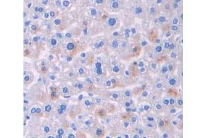 Used in DAB staining on fromalin fixed paraffin- embedded liver tissue (BCR antibody  (AA 1042-1268))