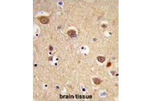 Immunohistochemistry (IHC) image for anti-Apoptosis-Inducing Factor, Mitochondrion-Associated, 1 (AIFM1) antibody (ABIN3003960) (AIF antibody)